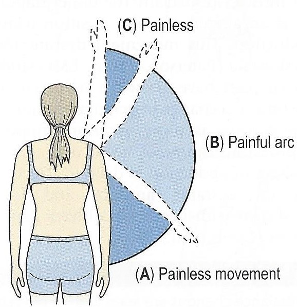 shoulder impingement pain moving shoulder through arc